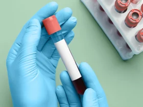 Blood Test