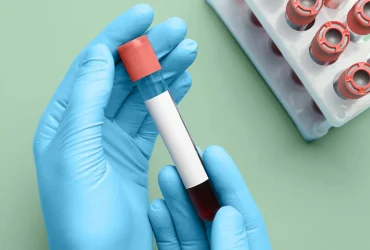Blood Test